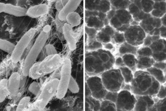 bacteria