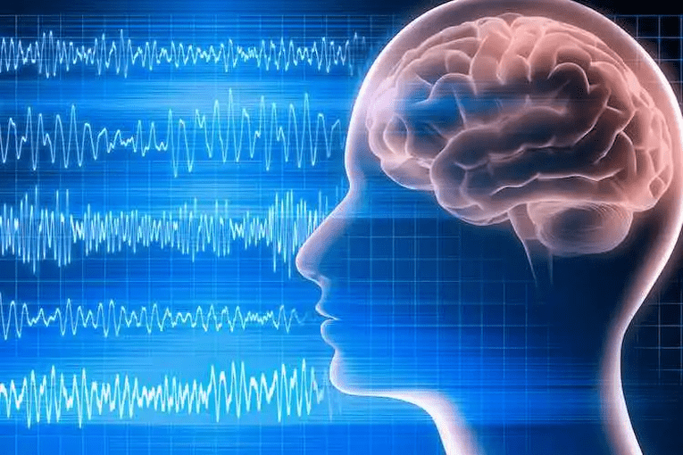 EEG