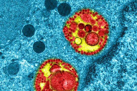 coronavirus-microscop 1